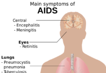 你对新加坡的艾滋病有什么了解?